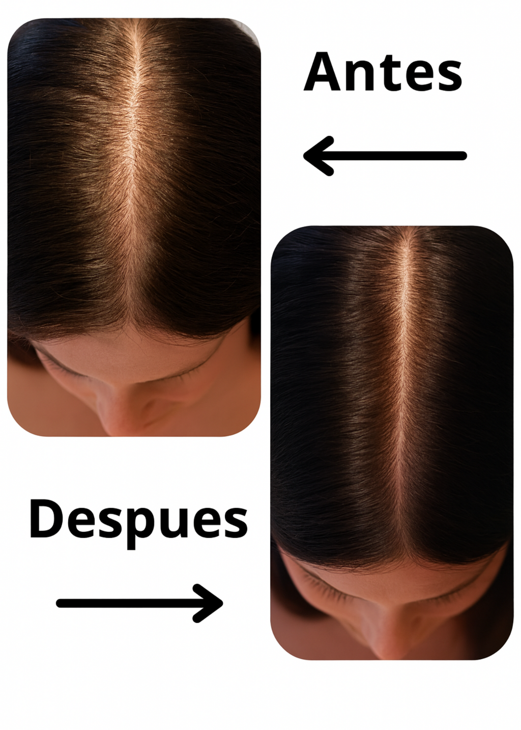 Cápsulas para el crecimiento del cabello MULTISEX