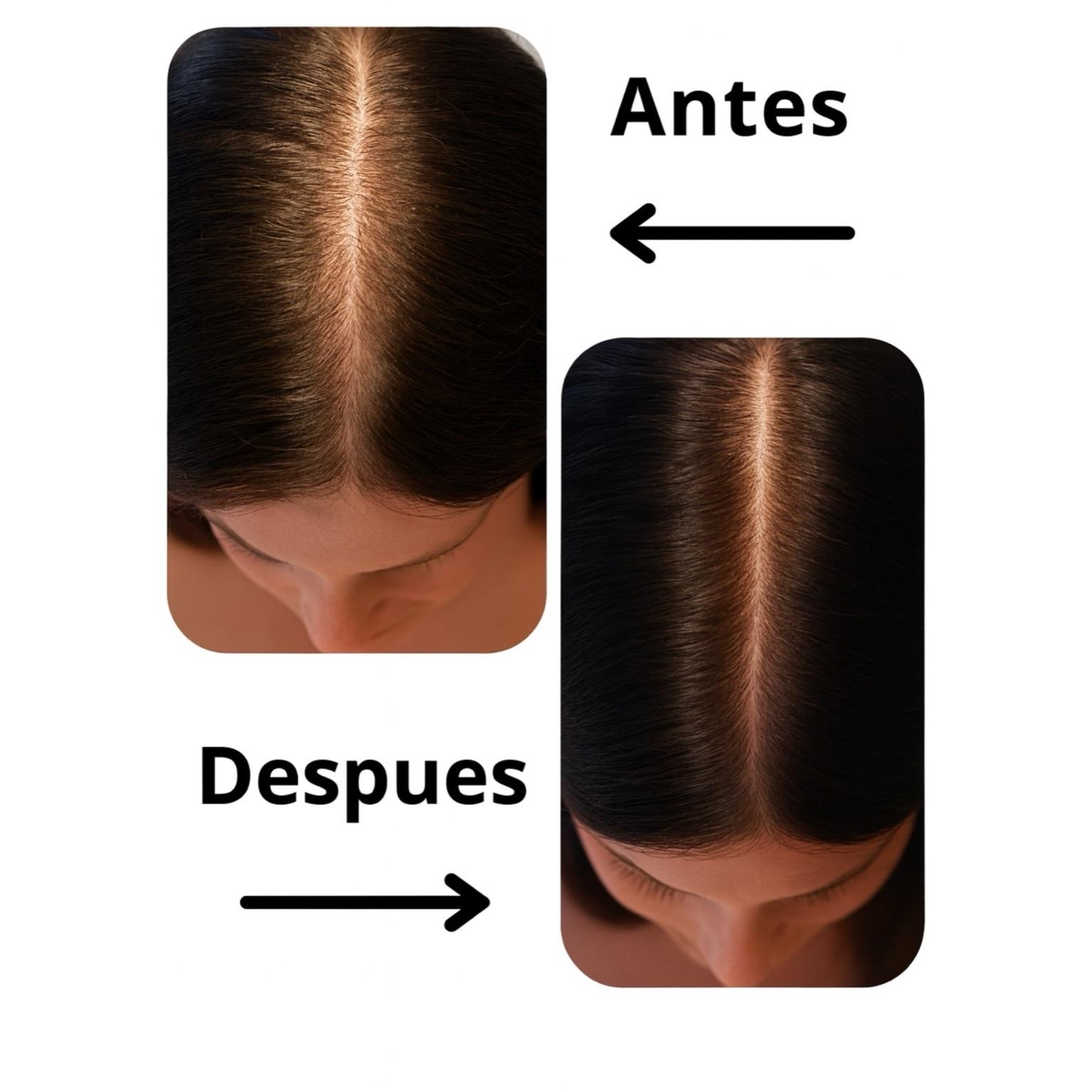 Cápsulas para el crecimiento del cabello MULTISEX